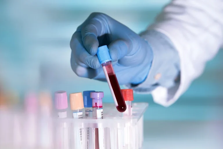 آزمایش خون تعیین جنسیت