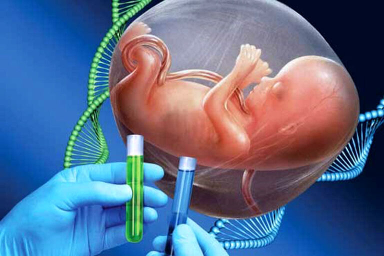 تشخیص عقب ماندگی ذهنی و جسمی جنین با آزمایش غربالگری