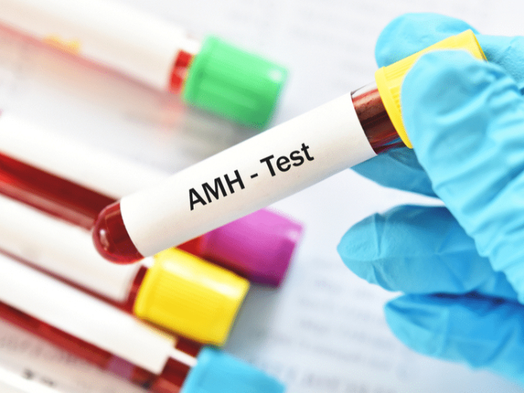 دلایل انجام آزمایش AMH