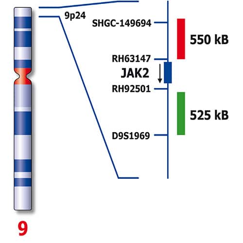 تشخیص جهش ژن JAK2 مانند V617F