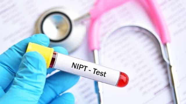 آزمایش NIPT