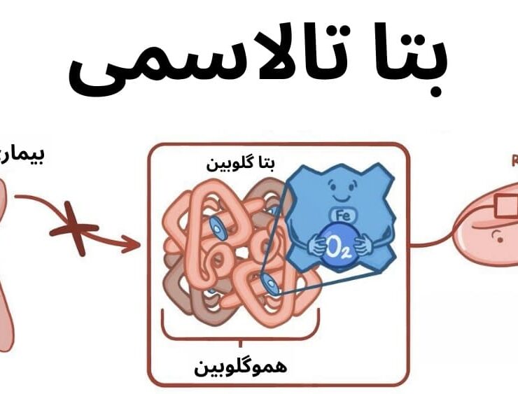 اگزوم - 3