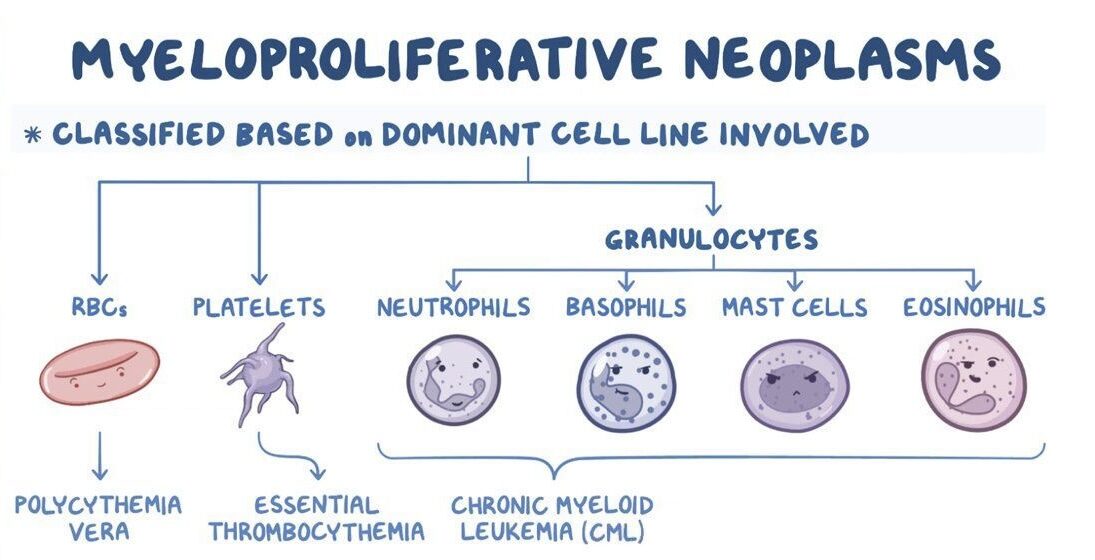نئوپلاسم های میلوپرولیفراتیو